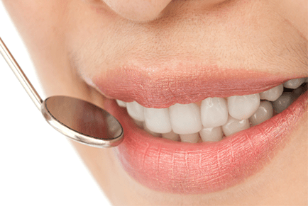 Teeth whitening treatment